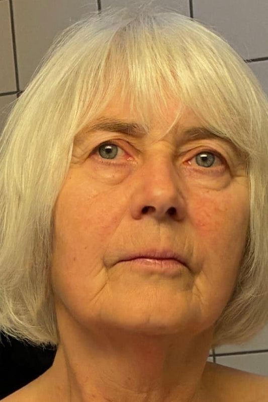 Johanne Botfeldt – 28 dages forløb